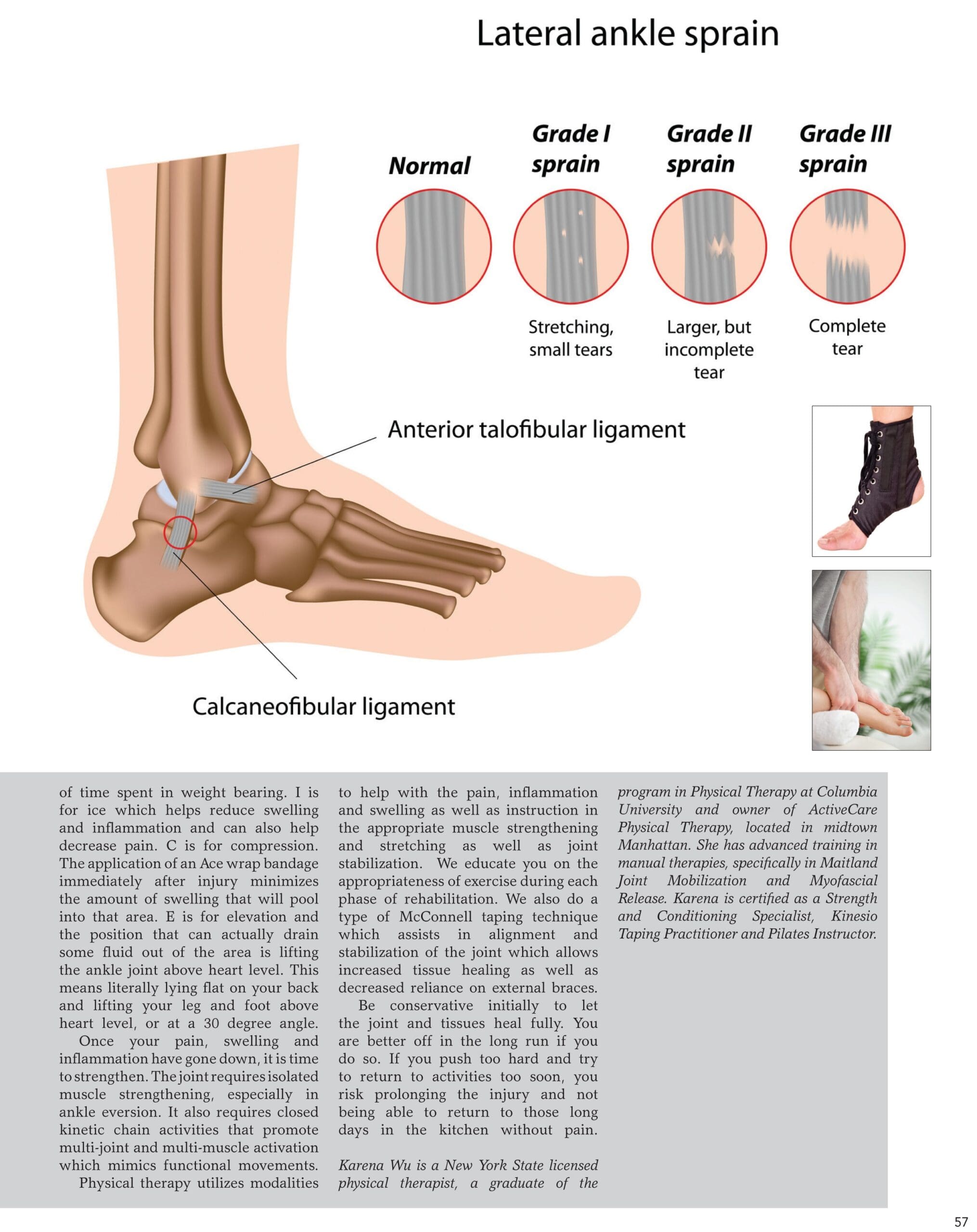 Most Popular Physical Therapy Options For A Sprained Foot
