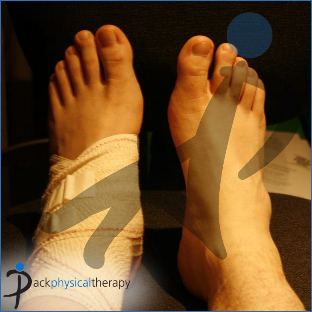 My Wellness Routine During A Sprained Foot Recovery