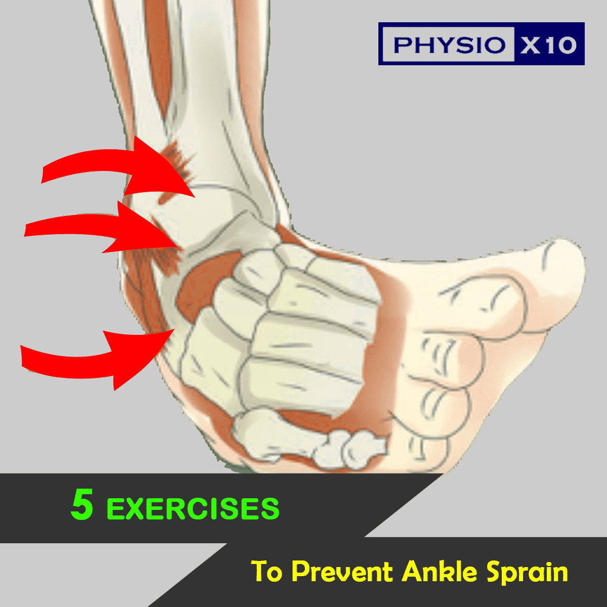 Preventing Foot Sprains: Precautions For High-Impact Activities