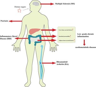The Relationship Between Sugar Intake And Inflammation In A Sprained Foot