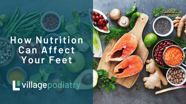 Best Sources Of Healthy Fats For Individuals With A Sprained Foot Best Sources Of Healthy Fats For Individuals With A Sprained Foot