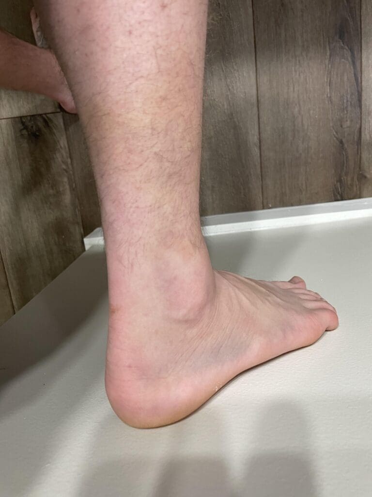 How To Safely Cross-Train After A Sprained Foot How To Safely Cross-Train After A Sprained Foot