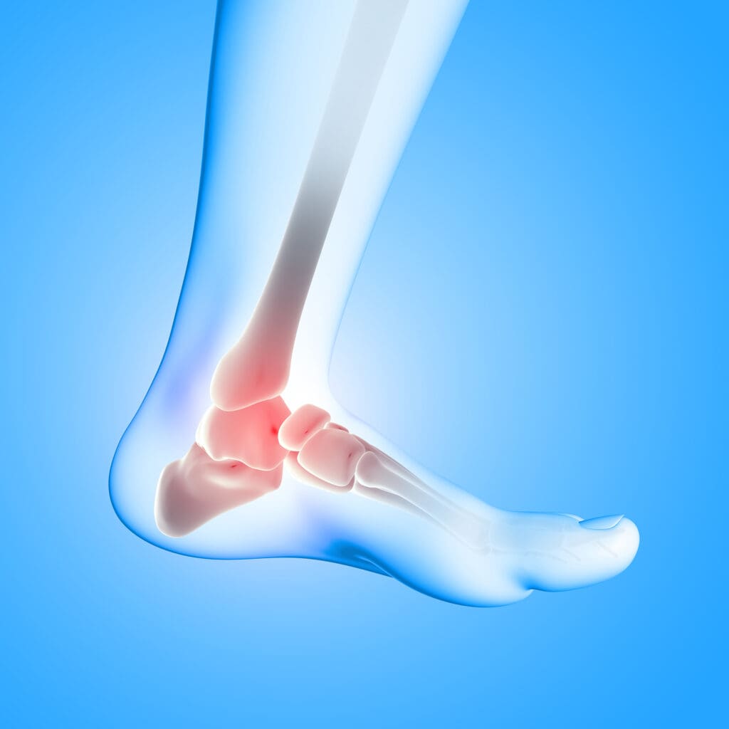 Preventing Foot Sprains: Tips For Avoiding Excessive Strain Preventing Foot Sprains: Tips For Avoiding Excessive Strain