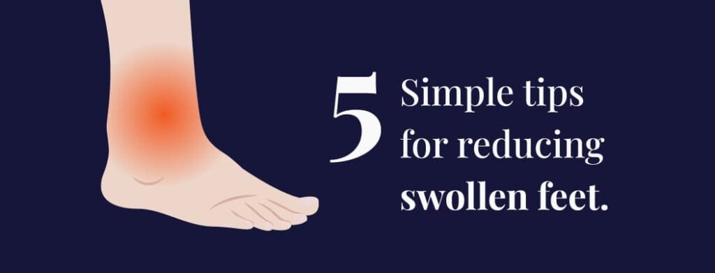 Top Ways To Manage Swelling And Edema During Foot Sprain Recovery
