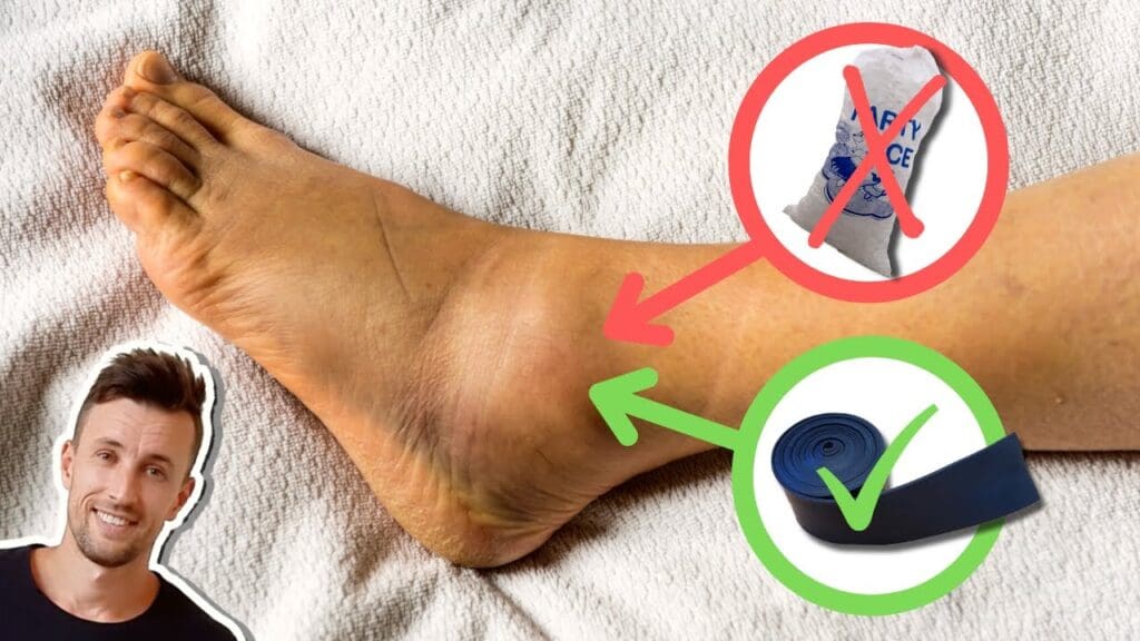 Top Ways To Speed Up The Recovery From A Sprained Foot Top Ways To Speed Up The Recovery From A Sprained Foot