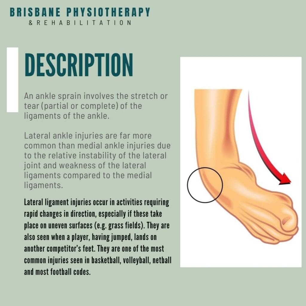 Understanding The Mechanics Of Foot Sprain Recovery Understanding The Mechanics Of Foot Sprain Recovery