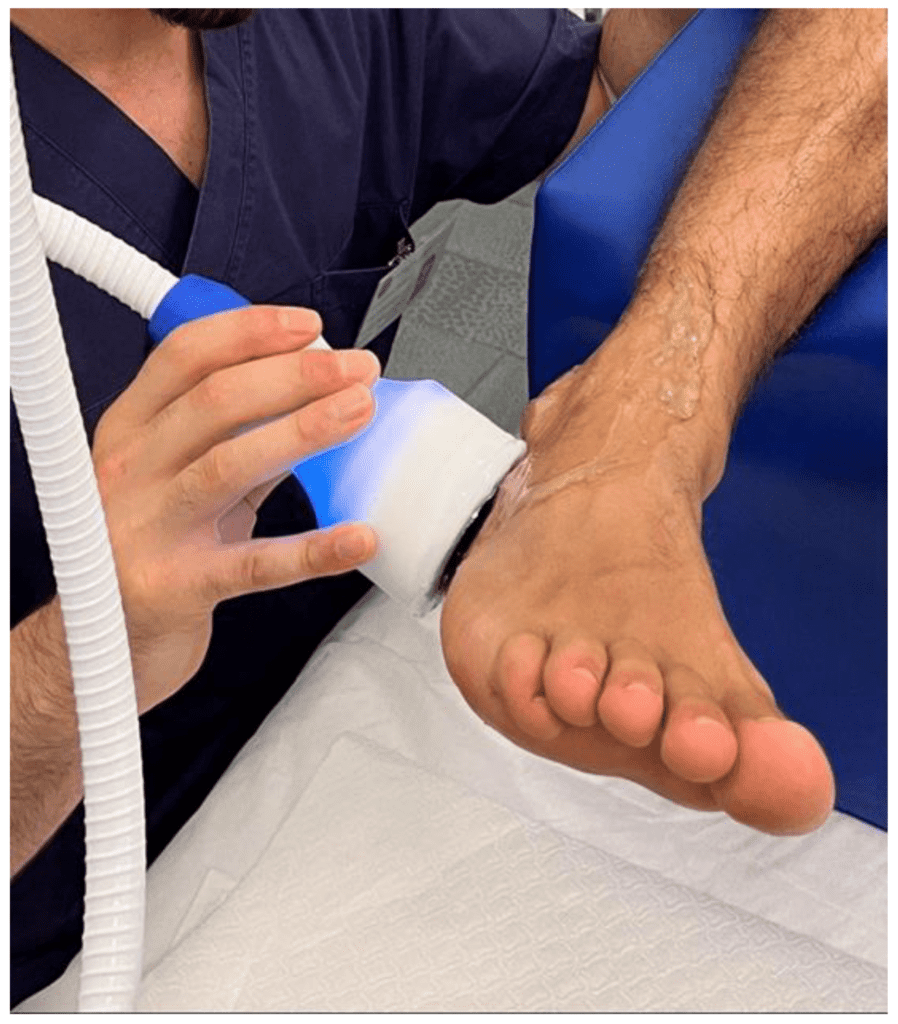 Expert Insights On Using Ice And Heat For A Sprained Foot Expert Insights On Using Ice And Heat For A Sprained Foot