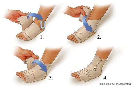 How To Protect Your Sprained Foot With The Right Footwear