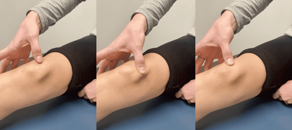 Top Ways To Reduce Scar Tissue Formation During Foot Sprain Recovery Top Ways To Reduce Scar Tissue Formation During Foot Sprain Recovery