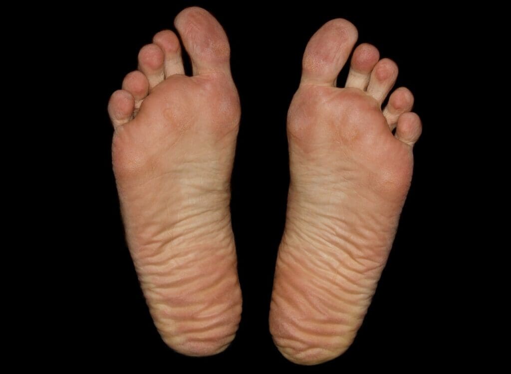 Beginners Guide To Using Hot And Cold Therapy For Sprained Foot