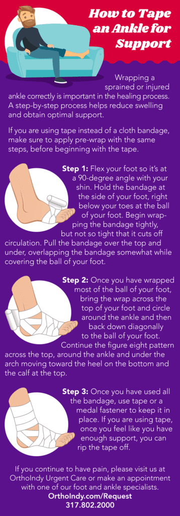 Learning To Listen To My Body While Healing From A Sprained Foot